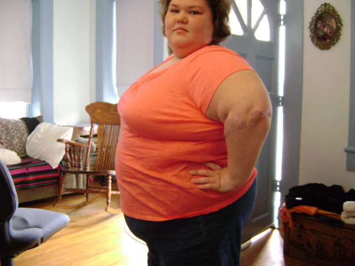 Here’s her before picture (450 pounds, and she is 5’2"). 
